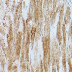 ATPase, Ca++ Transporting, Cardiac Muscle, Slow Twitch 2 (ATP2A2) Antibody