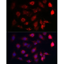 ATPase, Ca++ Transporting, Cardiac Muscle, Slow Twitch 2 (ATP2A2) Antibody