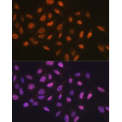Minichromosome Maintenance Deficient 7 (MCM7) Antibody