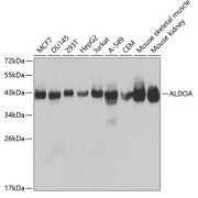 Western blot analysis of various lysates using ALDOA Antibody at 1/1000 dilution. Secondary antibody: HRP-conjugated Goat anti-Rabbit IgG (H+L) at 1/10000 dilution. Lysates/proteins: 25 µg per lane. Blocking buffer: 3% nonfat dry milk in TBST. Exposure time: 2s.