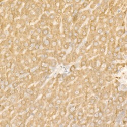Ferritin Heavy Chain (FTH1) Antibody