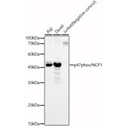 Western blot analysis of various lysates, using p47phox/NCF1 Antibody at 1/400 dilution. Secondary antibody: HRP-conjugated Goat anti-Rabbit IgG (H+L) at 1/10000 dilution. Lysates/proteins: 25 µg per lane. Blocking buffer: 3% nonfat dry milk in TBST. Exposure time: 180s.
