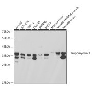 Western blot analysis of various lysates using Tropomyosin 1 Antibody at 1/1000 dilution. Secondary antibody: HRP-conjugated Goat anti-Rabbit IgG (H+L) at 1/10000 dilution. Lysates/proteins: 25 µg per lane. Blocking buffer: 3% nonfat dry milk in TBST.