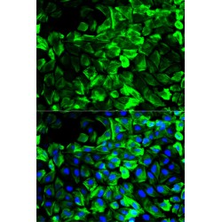 Tropomyosin 1 (TPM1) Antibody