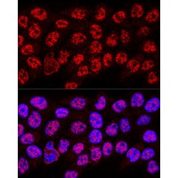 Heterogeneous Nuclear Ribonucleoprotein A2/B1 (HNRNPA2B1) Antibody
