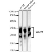 Western blot analysis of various lysates, using EpCAM Antibody at 1/1000 dilution. Secondary antibody: HRP-conjugated Goat anti-Rabbit IgG (H+L) at 1/10000 dilution. Lysates/proteins: 25 µg per lane. Blocking buffer: 3% nonfat dry milk in TBST. Exposure time: 10s.