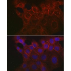 Tumor-Associated Calcium Signal Transducer 1 (TACSTD1) Antibody