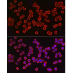 Tumor-Associated Calcium Signal Transducer 1 (TACSTD1) Antibody