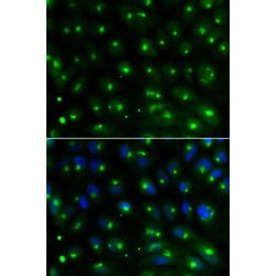 ADP Ribosylation Factor Binding Protein GGA2 (GGA2) Antibody