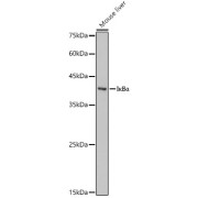 abx001101