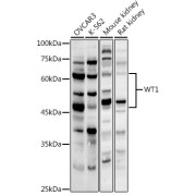 Western blot analysis of various lysates using WT1 Antibody at 1/1000 dilution. Secondary antibody: HRP-conjugated Goat anti-Rabbit IgG (H+L) at 1/10000 dilution. Lysates/proteins: 25 µg per lane. Blocking buffer: 3% nonfat dry milk in TBST. Exposure time: 180s.