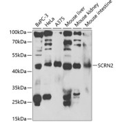 Western blot analysis of various lysates using SCRN2 Antibody at 1/1000 dilution. Secondary antibody: HRP-conjugated Goat anti-Rabbit IgG (H+L) at 1/10000 dilution. Lysates/proteins: 25 µg per lane. Blocking buffer: 3% nonfat dry milk in TBST.