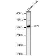 Western blot analysis of lysates from Mouse heart, using SRPX Antibody at 1/1000 dilution. Secondary antibody: HRP-conjugated Goat anti-Rabbit IgG (H+L) at 1/10000 dilution. Lysates/proteins: 25 µg per lane. Blocking buffer: 3% nonfat dry milk in TBST. Exposure time: 30s.