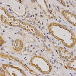 Rho GTPase Activating Protein 25 (ARHGAP25) Antibody