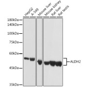 abx001138