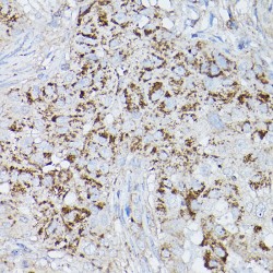 Aldehyde Dehydrogenase, Mitochondrial (ALDH2) Antibody