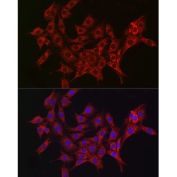 Aldehyde Dehydrogenase, Mitochondrial (ALDH2) Antibody