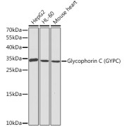 abx001144