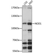 abx001158