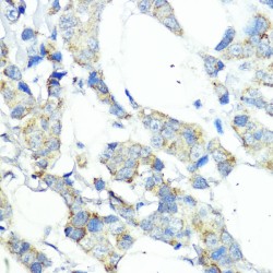 Nucleotide-Binding Oligomerization Domain-Containing Protein 1 (NOD1) Antibody