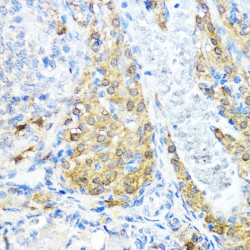 Nucleotide-Binding Oligomerization Domain-Containing Protein 1 (NOD1) Antibody