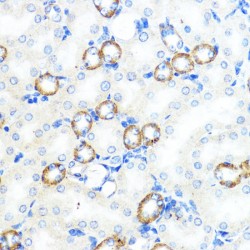 Nucleotide-Binding Oligomerization Domain-Containing Protein 1 (NOD1) Antibody