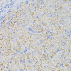 Acyl-CoA Dehydrogenase, Long Chain (ACADL) Antibody