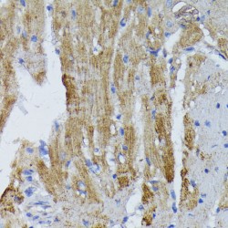 Acyl-CoA Dehydrogenase, Long Chain (ACADL) Antibody