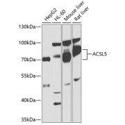 Western blot analysis of various lysates using ACSL5 Antibody at 1/1000 dilution. Secondary antibody: HRP-conjugated Goat anti-Rabbit IgG (H+L) at 1/10000 dilution. Lysates/proteins: 25 µg per lane. Blocking buffer: 3% nonfat dry milk in TBST. Exposure time: 1s.