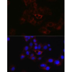Apolipoprotein B (APOB) Antibody
