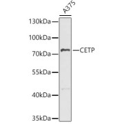 Western blot analysis of lysates from A375 cells, using CETP Antibody at 1/1000 dilution. Secondary antibody: HRP-conjugated Goat anti-Rabbit IgG (H+L) at 1/10000 dilution. Lysates/proteins: 25 µg per lane. Blocking buffer: 3% nonfat dry milk in TBST. Exposure time: 15s.