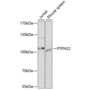 Western blot analysis of various lysates using PTPN22 Antibody at 1/1000 dilution. Secondary antibody: HRP-conjugated Goat anti-Rabbit IgG (H+L) at 1/10000 dilution. Lysates/proteins: 25 µg per lane. Blocking buffer: 3% nonfat dry milk in TBST. Exposure time: 5s.