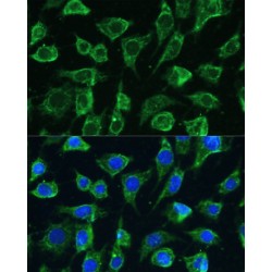 Protein Tyrosine Phosphatase, Non Receptor Type 22 (PTPN22) Antibody