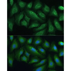 Protein Tyrosine Phosphatase, Non Receptor Type 22 (PTPN22) Antibody