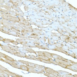 Dystrophin (DMD) Antibody