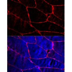 Dystrophin (DMD) Antibody