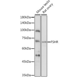 Follicle Stimulating Hormone Receptor (FSHR) Antibody
