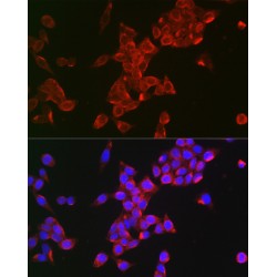 Follicle Stimulating Hormone Receptor (FSHR) Antibody