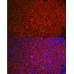 Follicle Stimulating Hormone Receptor (FSHR) Antibody