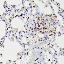Histone Deacetylase 9 (HDAC9) Antibody