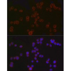 T-Cell Surface Glycoprotein CD4 (CD4) Antibody