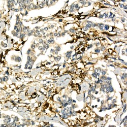 Lymphotoxin Alpha (LTA) Antibody