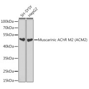 Western blot analysis of various lysates using Muscarinic AChR M2 (ACM2) Antibody at 1/1000 dilution. Secondary antibody: HRP-conjugated Goat anti-Rabbit IgG (H+L) at 1/10000 dilution. Lysates/proteins: 25 µg per lane. Blocking buffer: 3% nonfat dry milk in TBST.