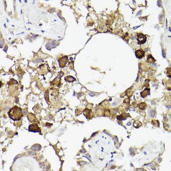 Interleukin 6 Receptor (IL6R) Antibody