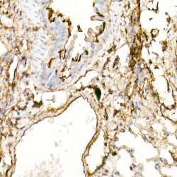 Annexin A2 (ANXA2) Antibody
