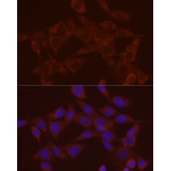 Annexin A2 (ANXA2) Antibody