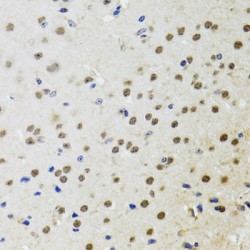 Tyrosine-Protein Kinase BTK (BTK) Antibody