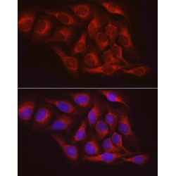 Tyrosine-Protein Phosphatase Non-Receptor Type 1 (PTPN1) Antibody