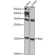 Western blot analysis of various lysates using Bad Antibody at 1/1000 dilution. Secondary antibody: HRP-conjugated Goat anti-Rabbit IgG (H+L) at 1/10000 dilution. Lysates/proteins: 25 µg per lane. Blocking buffer: 3% nonfat dry milk in TBST. Exposure time: 90s.
