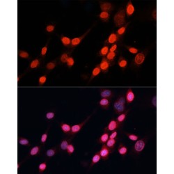 DNA Repair Protein Complementing XP-G Cells (ERCC5) Antibody